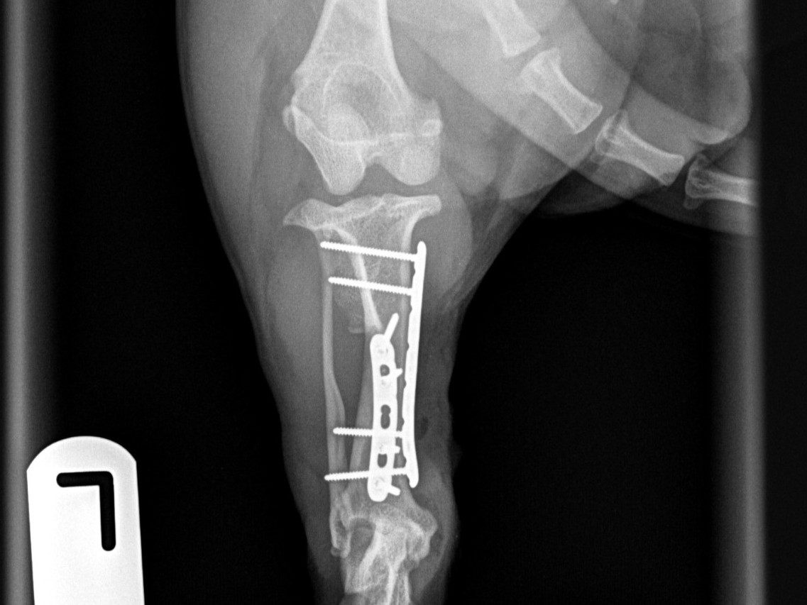 Post-op cd-cr view