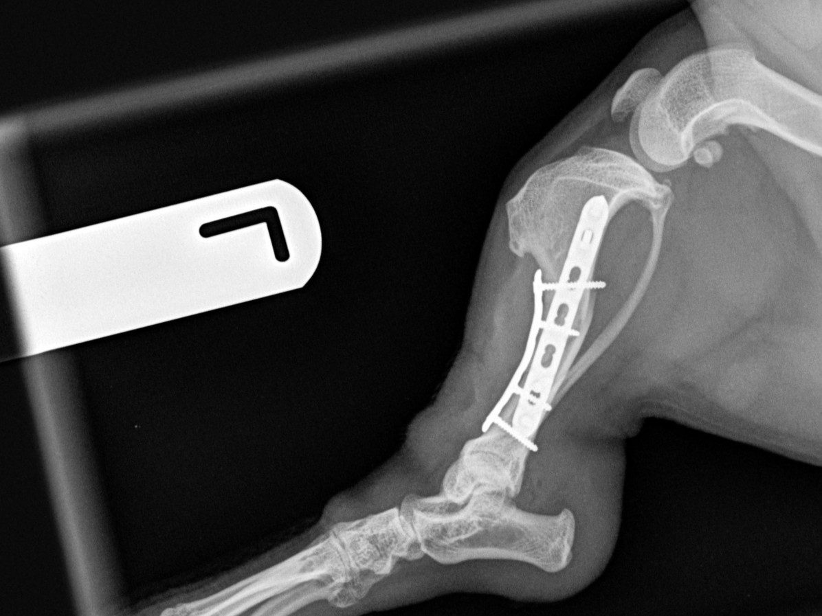 Post-op lateral view