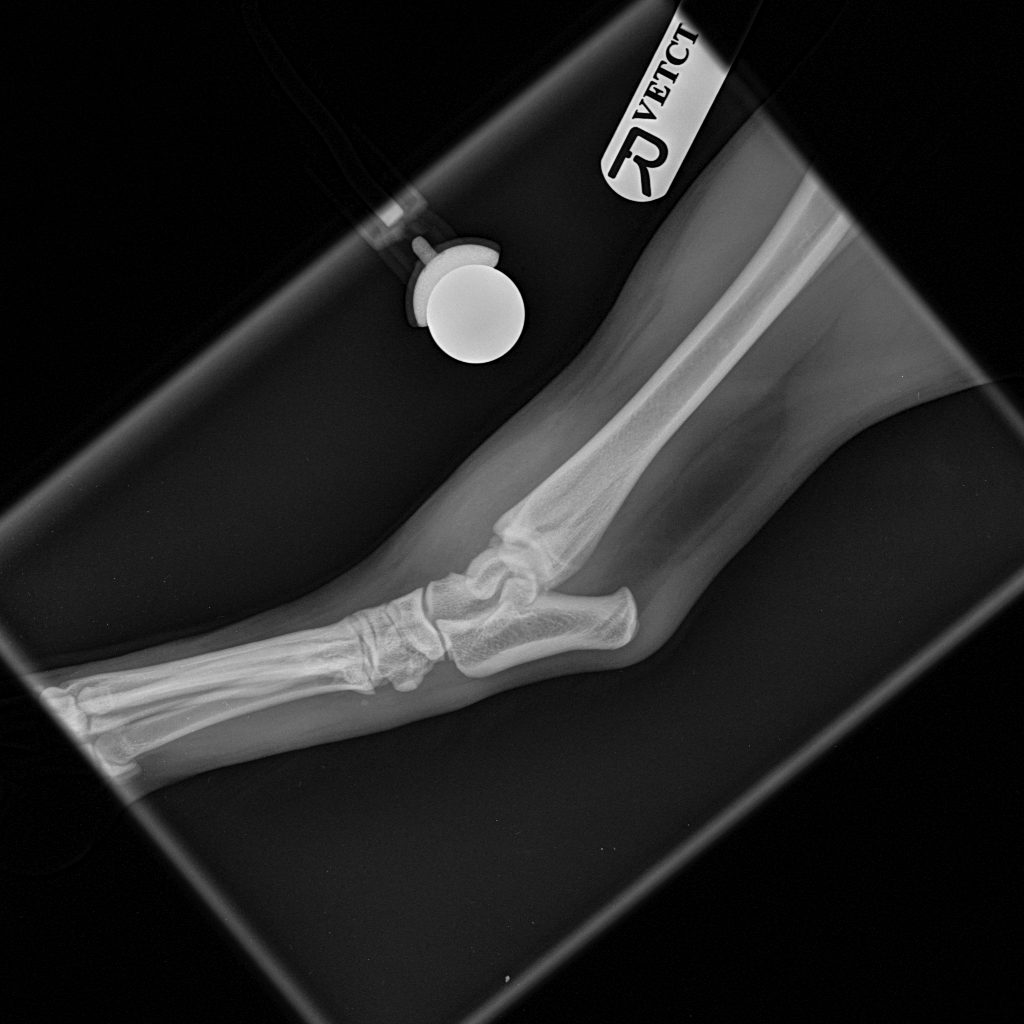 Pre-op lat view
