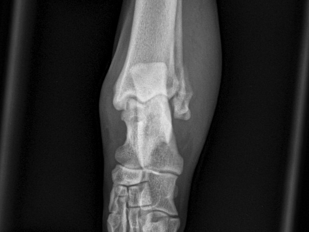 Pre-op cd-cr view