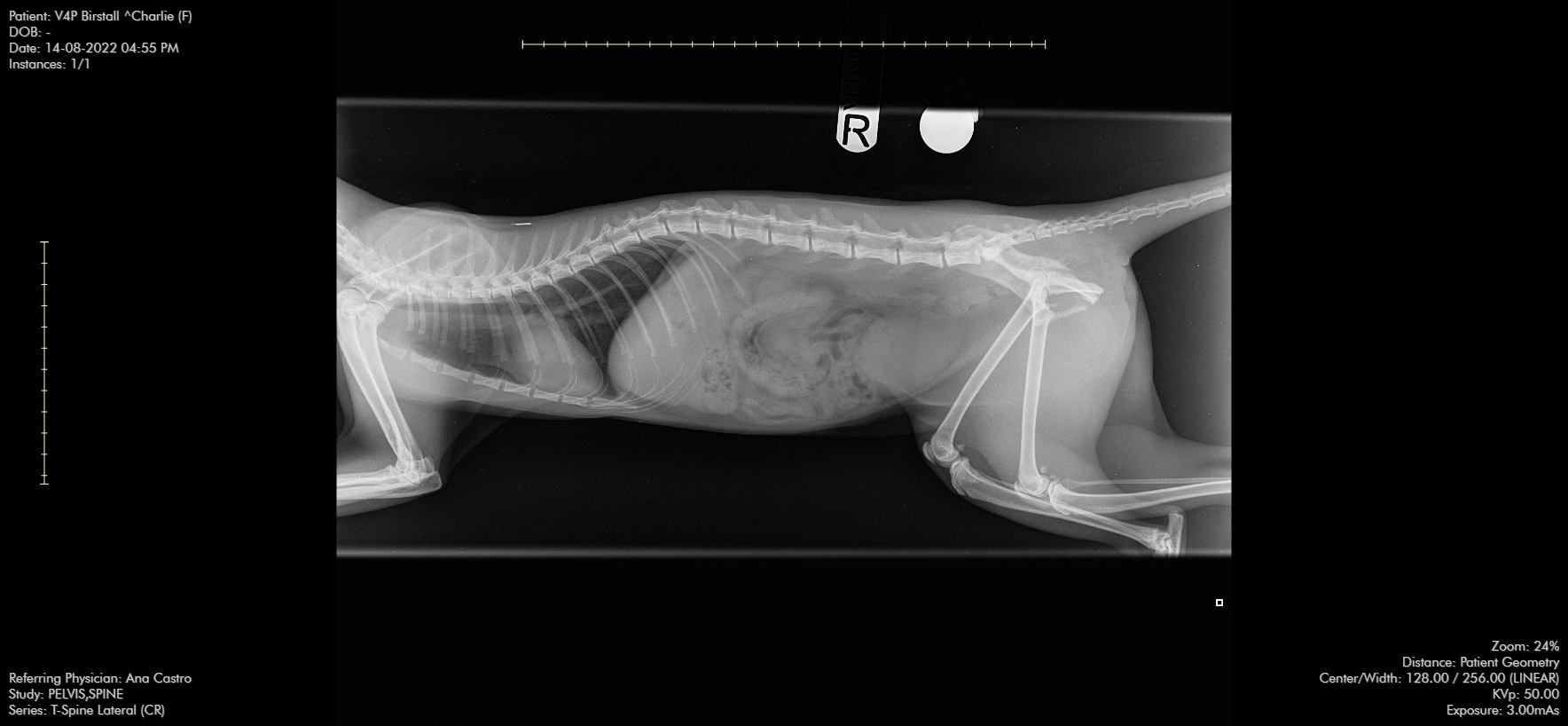 Pre-op pelvis lat view