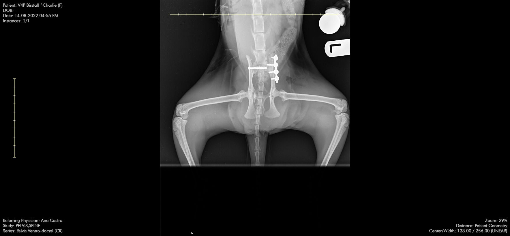 Post-op stabilisation