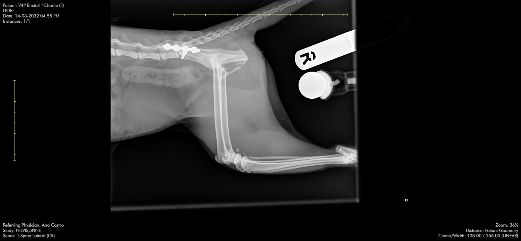 Post-op lat view