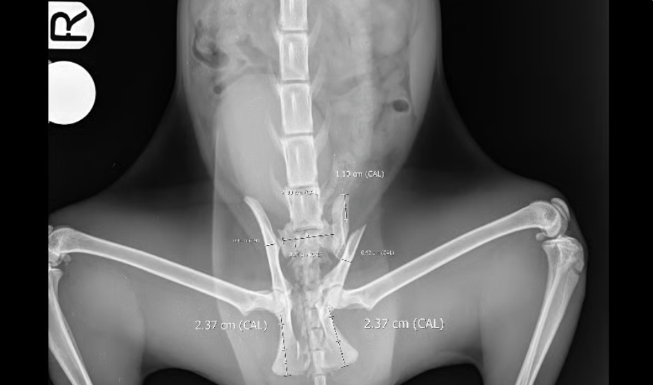 Case 01 — Charlie — Ilial wing fracture