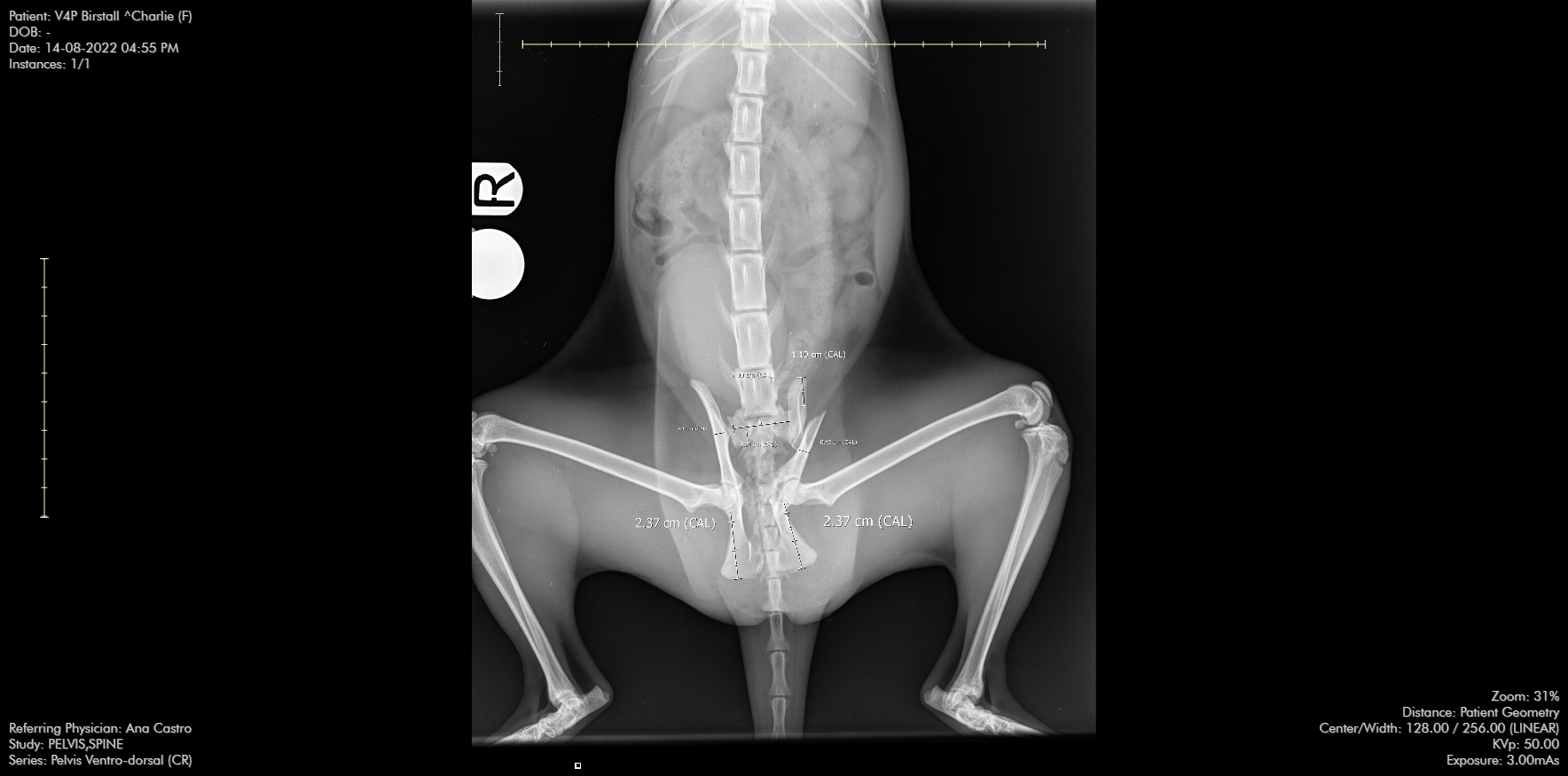 Pre-op pelvis