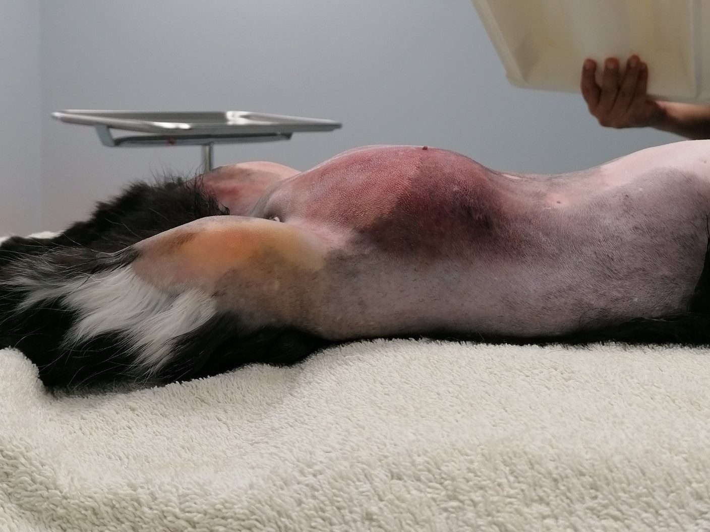 Extensive bruising after clipping