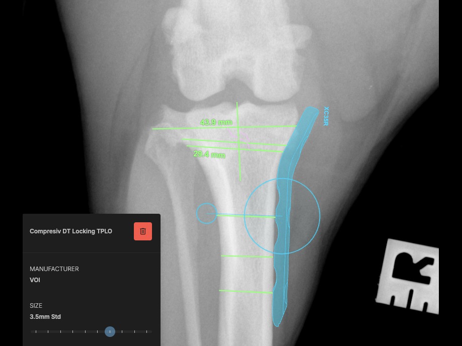 Surgical planning, cd-cr view