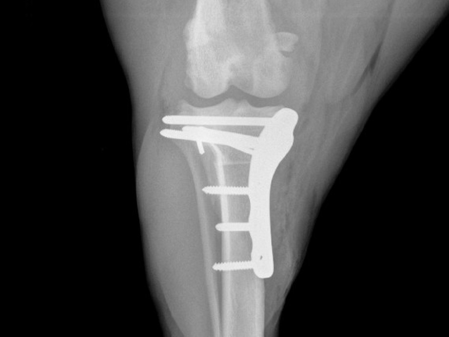 Post-op cd-cr view