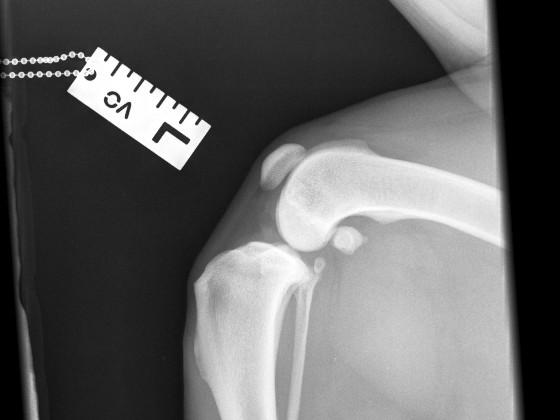 Contralateral normal stifle