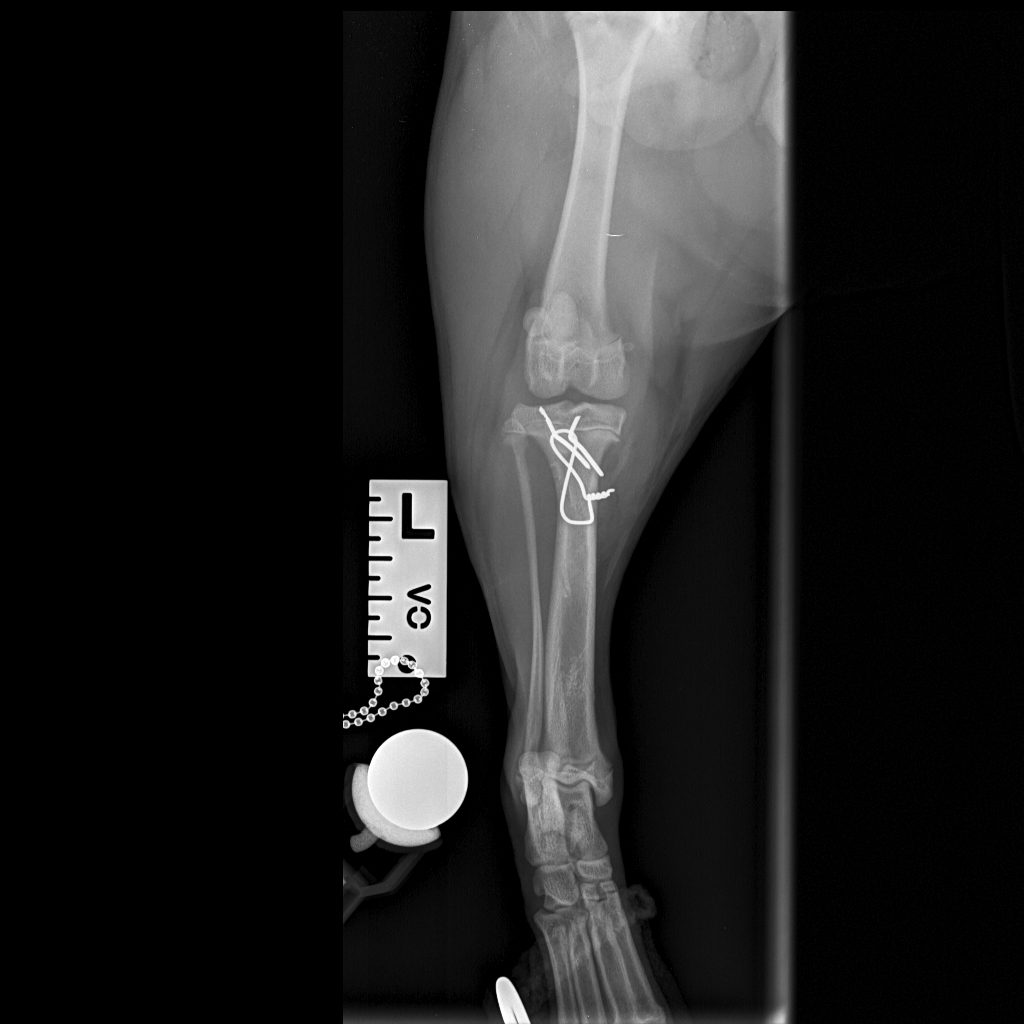 Post-op cd-cr view