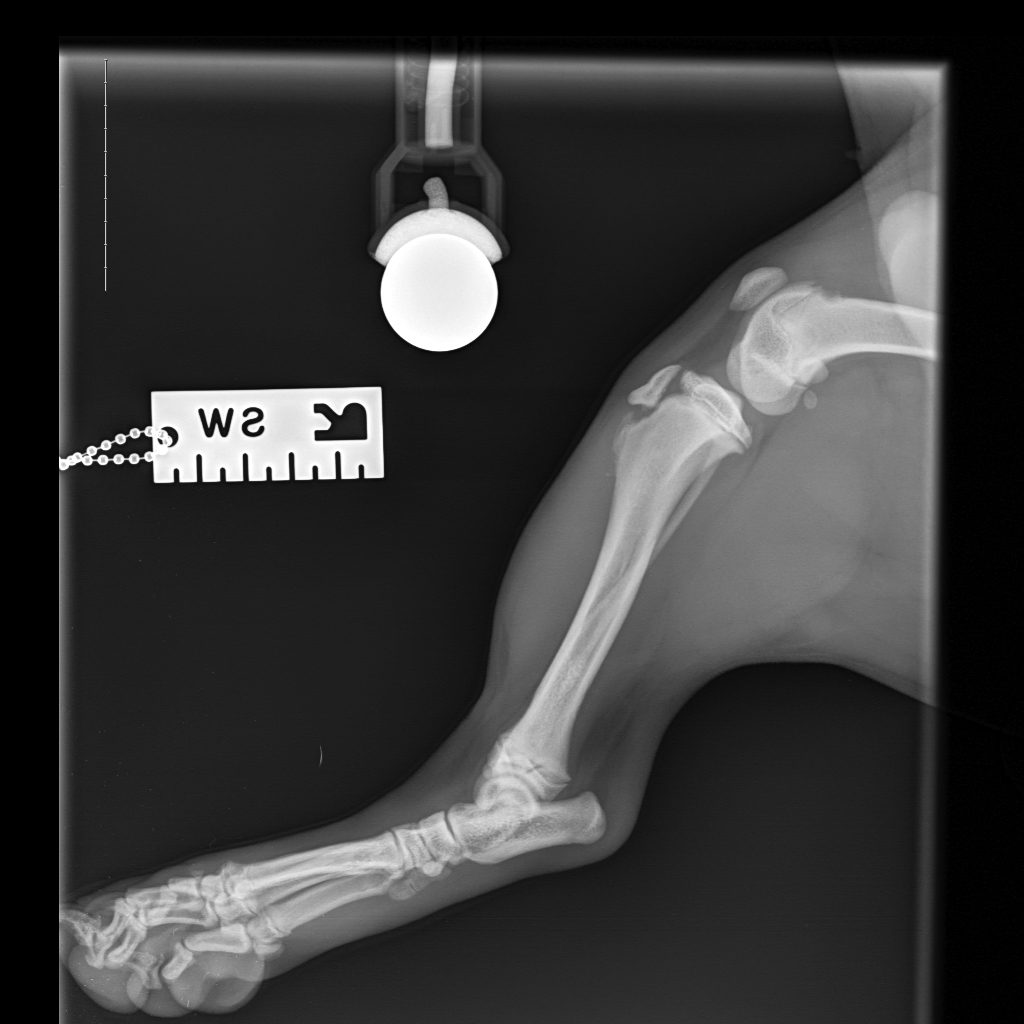 Contralateral right limb