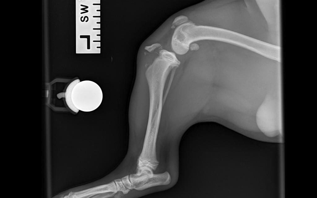 Case 03 — Ralph — Tibial tuberosity avulsion fracture