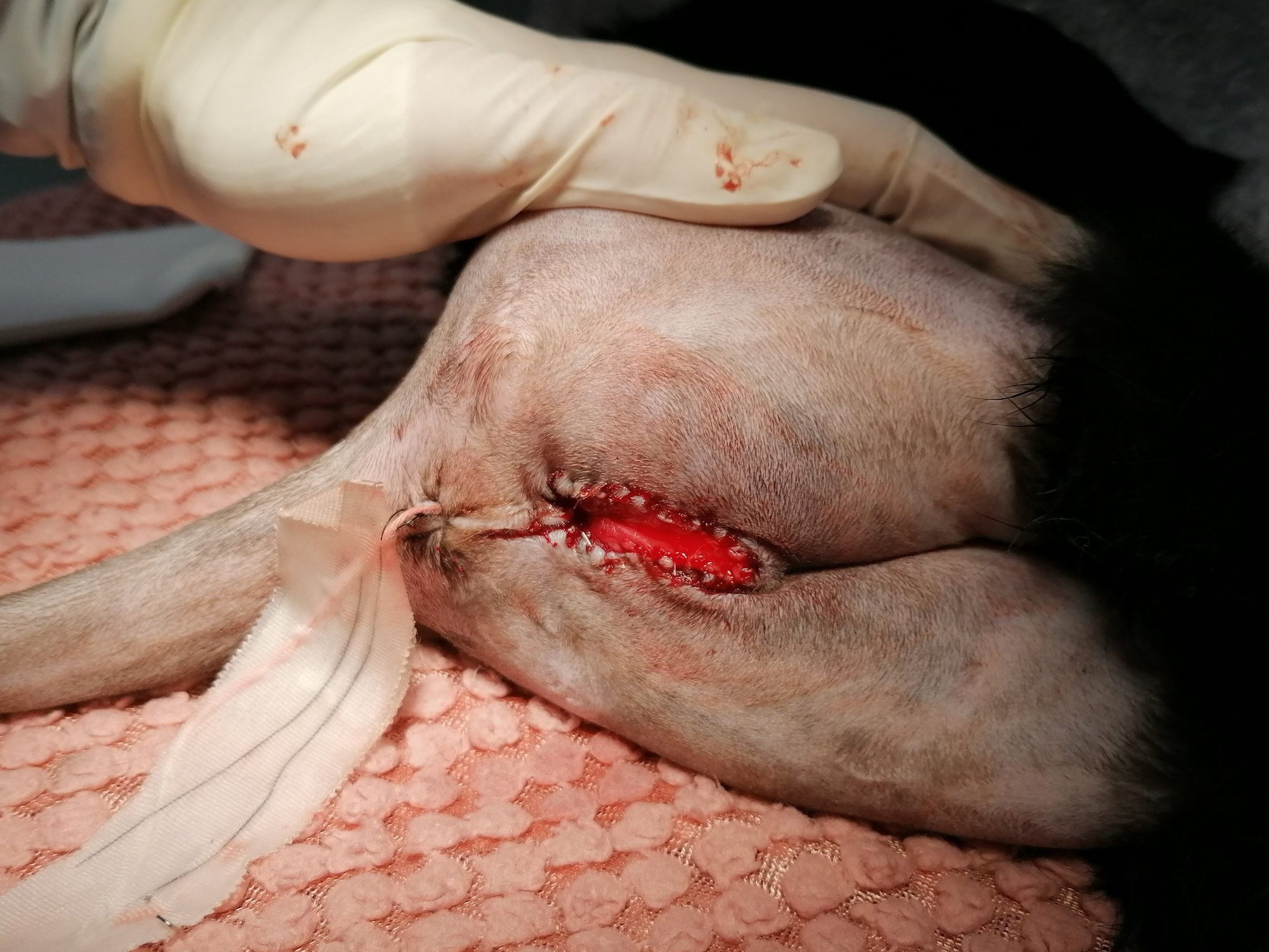 Surgical site